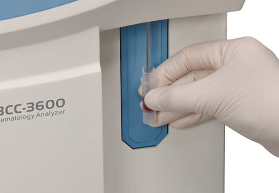 Hematology Analyzer - Smart Medical EG Products